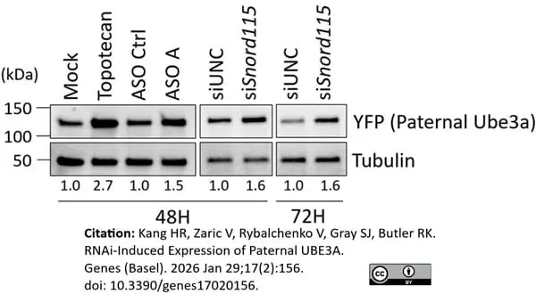ANTI-TUBULIN hFAB™ Rhodamine Antibody Antibody, clone AbD22584 gallery image 17