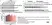ANTI-TUBULIN hFAB™ Rhodamine Antibody Antibody, clone AbD22584 thumbnail image 18