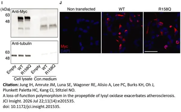 ANTI-TUBULIN hFAB™ Rhodamine Antibody Antibody, clone AbD22584 gallery image 19