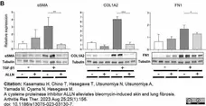 ANTI-TUBULIN hFAB™ Rhodamine Antibody Antibody, clone AbD22584 gallery image 6