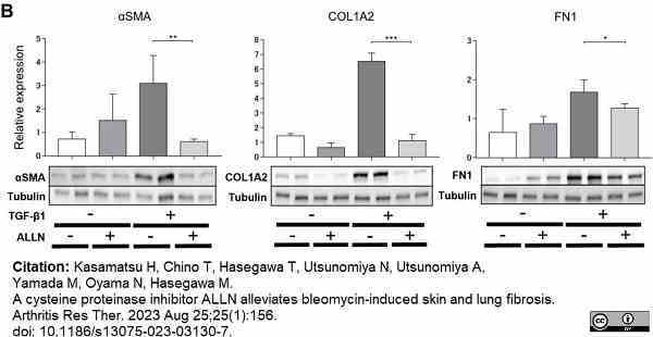 ANTI-TUBULIN hFAB™ Rhodamine Antibody Antibody, clone AbD22584 gallery image 6