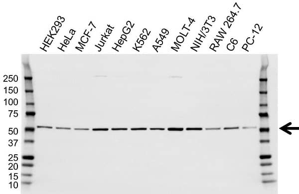Anti Tubulin Beta 2A Chain Antibody (PrecisionAb Monoclonal Antibody) gallery image 1