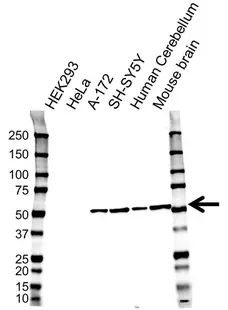Anti Tubulin Beta 3 Antibody, clone OTI5H2 (PrecisionAb Monoclonal Antibody) gallery image 3
