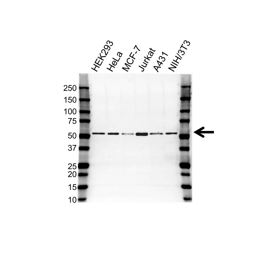 Anti Tubulin Beta Chain Antibody, clone 87CT59.3.7 (PrecisionAb Monoclonal Antibody) gallery image 1