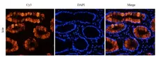 Anti Tumor Associated Glycoprotein 72 (Satumomab Biosimilar) Antibody, clone B72.3 gallery image 1