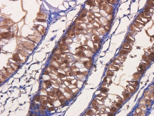 Anti Tumor Associated Glycoprotein 72 (Satumomab Biosimilar) Antibody, clone B72.3 gallery image 2
