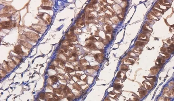Anti Tumor Associated Glycoprotein 72 (Satumomab Biosimilar) Antibody, clone B72.3 gallery image 2