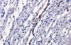 Anti Tumor Associated Glycoprotein 72 (Satumomab Biosimilar) Antibody, clone B72.3 gallery image 3