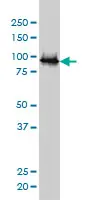 Anti Human UBE3A Antibody, clone 2F6 gallery image 3