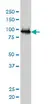Anti Human UBE3A Antibody, clone 2F6 thumbnail image 3