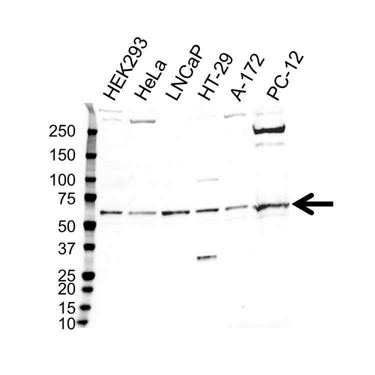 Anti USP14 Antibody (PrecisionAb Monoclonal Antibody) gallery image 1
