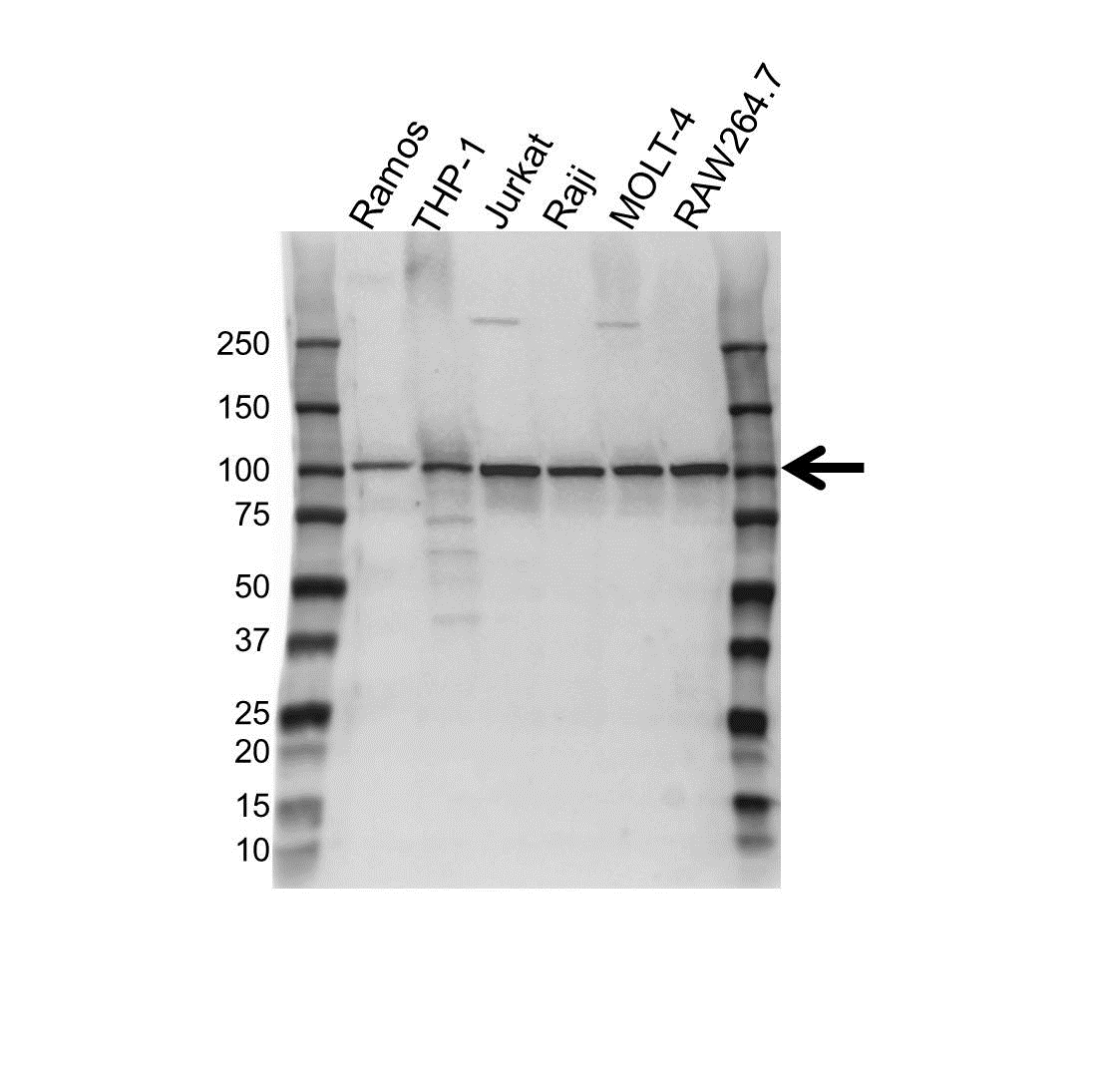 Anti VAV1 Antibody, clone 1582CT802.383 (PrecisionAb Monoclonal Antibody) gallery image 1
