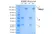 Anti VEGF (Bevacizumab Biosimilar) Antibody, clone Bevacizumab thumbnail image 1