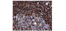 Anti Vimentin Antibody, clone AbD2701 (PrecisionAb Monoclonal Antibody) gallery image 3