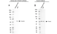 Anti Vimentin Antibody, clone AbD2701 (PrecisionAb Monoclonal Antibody) gallery image 4