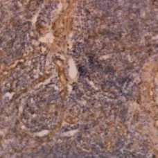 Anti Human Vinculin Antibody, clone V284 gallery image 1