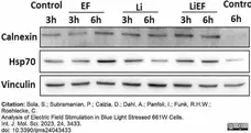 Anti Human Vinculin Antibody, clone V284 gallery image 5