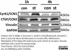Anti Human Vinculin Antibody, clone V284 gallery image 6
