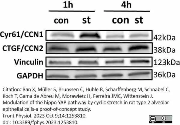 Anti Human Vinculin Antibody, clone V284 gallery image 6