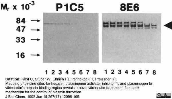 Anti Human Vitronectin Antibody, clone 8E6 (1.110) gallery image 1