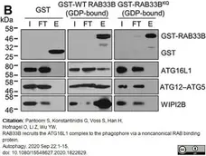 Anti WIPI2 Antibody, clone 2A2 gallery image 1