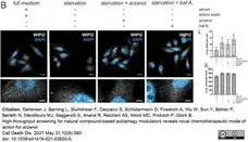 Anti WIPI2 Antibody, clone 2A2 gallery image 2