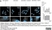 Anti WIPI2 Antibody, clone 2A2 thumbnail image 2