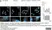 Anti WIPI2 Antibody, clone 2A2 thumbnail image 2