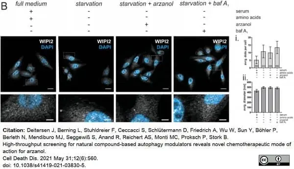 Anti WIPI2 Antibody, clone 2A2 gallery image 2