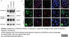 Anti WIPI2 Antibody, clone 2A2 gallery image 4