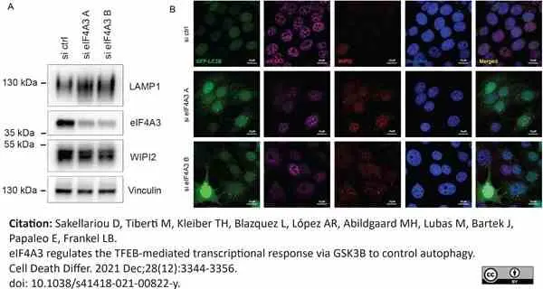 Anti WIPI2 Antibody, clone 2A2 gallery image 4
