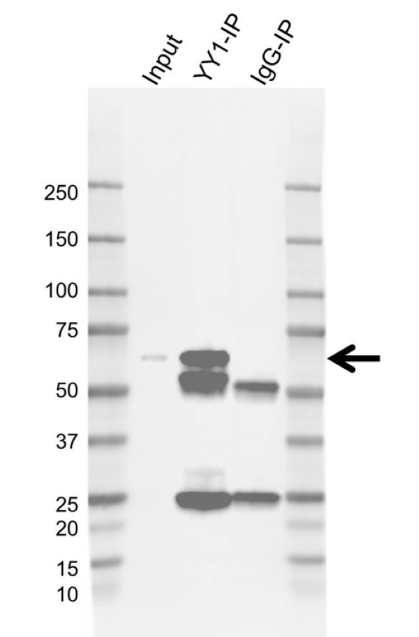 Anti YY1 Antibody, clone CD02/2B2 (PrecisionAb Monoclonal Antibody) gallery image 2