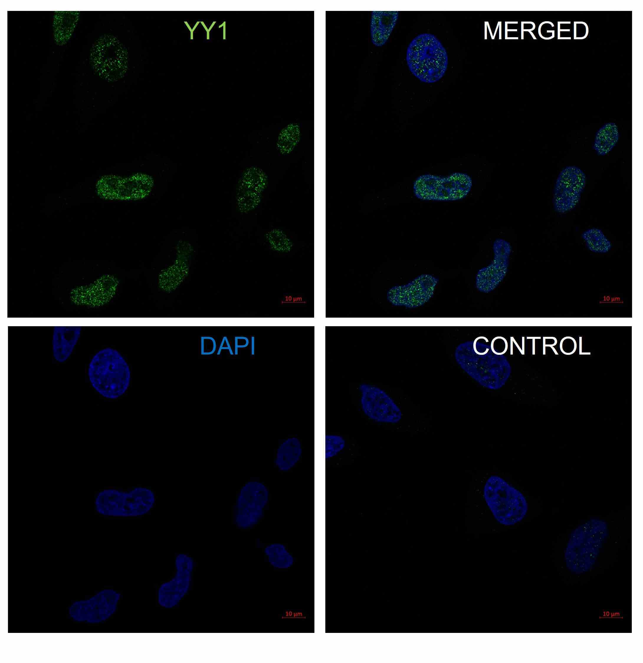 Anti YY1 Antibody, clone CD02/2B2 (PrecisionAb Monoclonal Antibody) gallery image 3