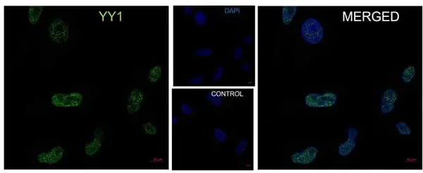 Anti YY1 Antibody, clone CD02/2B2 (PrecisionAb Monoclonal Antibody) gallery image 3