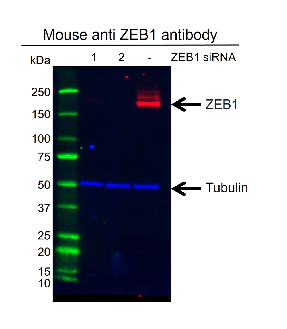 Anti ZEB1 Antibody, clone OTI8E2 (PrecisionAb Monoclonal Antibody) gallery image 2