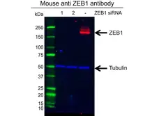 Anti ZEB1 Antibody, clone OTI8E2 (PrecisionAb Monoclonal Antibody) gallery image 2