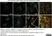 Anti Huntingtin Antibody, clone HDB4E10 thumbnail image 2