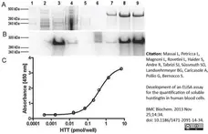 Anti Huntingtin Antibody, clone HDB4E10 gallery image 3