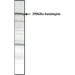 Anti Huntingtin Antibody, clone HDC8A4 gallery image 1