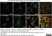 Anti Huntingtin Antibody, clone HDC8A4 thumbnail image 2