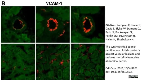 Anti Mouse CD106 Antibody, clone MVCAM A (429) gallery image 2