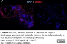 Anti Mouse CD11b Antibody, clone 5C6 gallery image 120