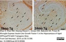 Anti Mouse CD11b Antibody, clone 5C6 gallery image 23