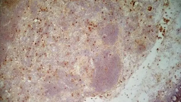 Anti Mouse CD11b Antibody, clone 5C6 gallery image 9