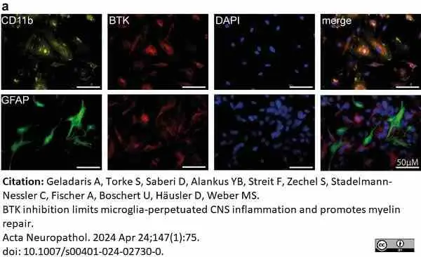 Anti Mouse CD11b Antibody, clone 5C6 gallery image 94