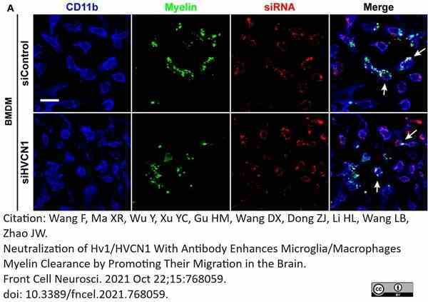 Anti Mouse CD11b Antibody, clone 5C6 gallery image 96