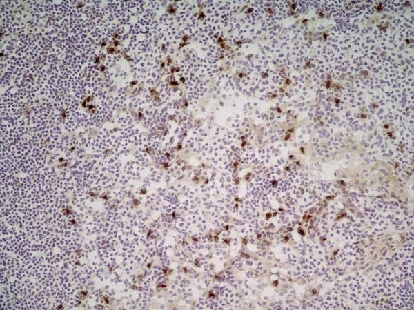 Anti Mouse CD11b Antibody, clone M1/70.15 gallery image 11
