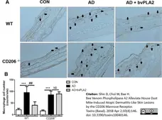 Anti Mouse CD11b Antibody, clone M1/70.15 gallery image 13