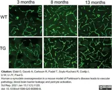 Anti Mouse CD13 Antibody, clone R3-63 gallery image 13