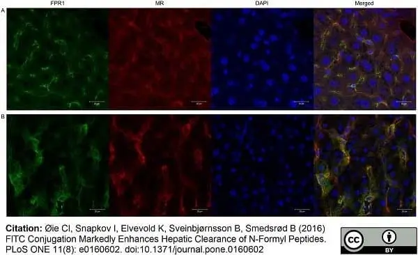 Anti Mouse CD206 Antibody, clone MR5D3 gallery image 10
